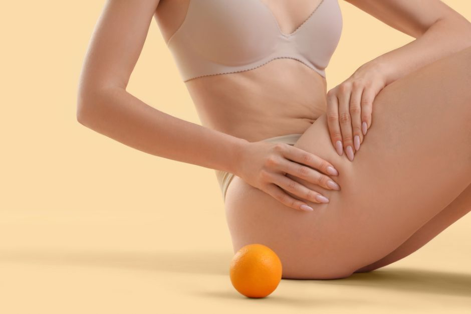Készülj a bikiniszezonra: mondj búcsút a narancsbőrnek!